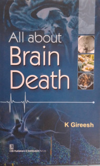 All about Brain Death