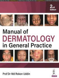 Manul of Dermatology in General Practice