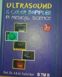 Ultrasound & Color Doppler in Medical Science